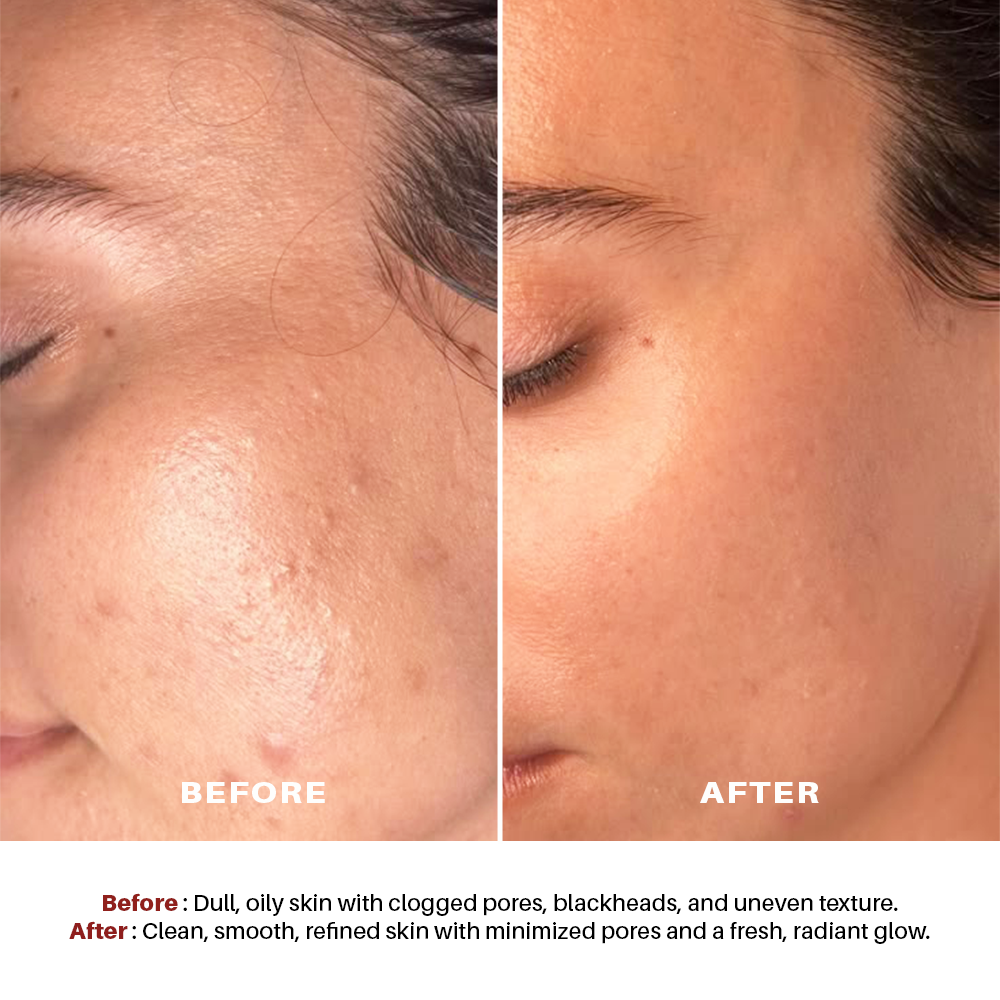 Seasoul Peel-Off Mask Activated Charcoal & Dead Sea Mud (20g)