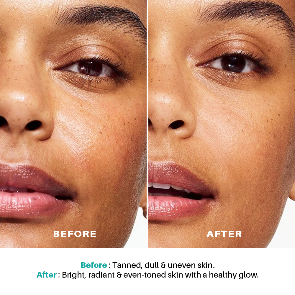 Seasoul SunDust Detox De-Tan Cream with Vitamin C & Alpha Arbutin | For Radiant, Even-Toned Skin (Pack 6)