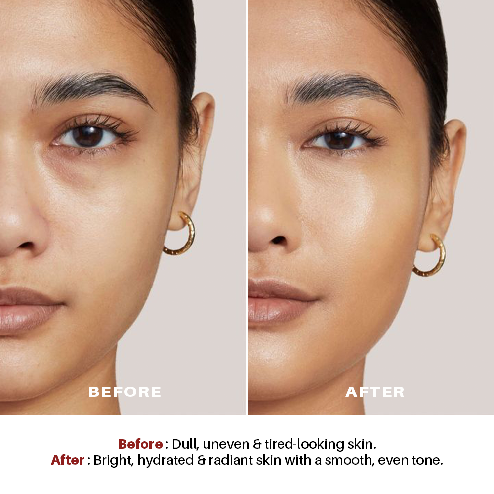 Azevita Intense Brightening Day Cream (100gm)