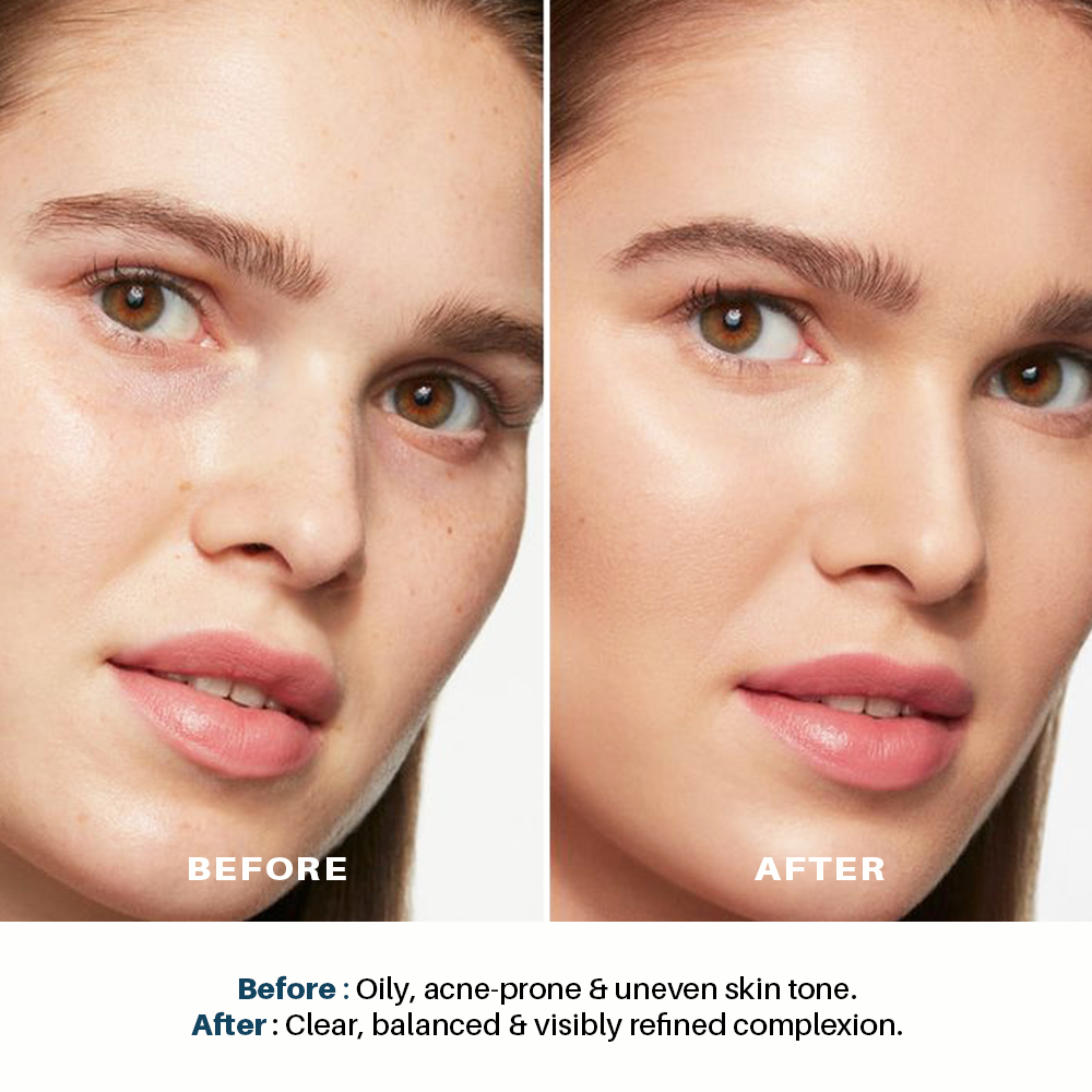 Seasoul Clarifying Serum With Dead Sea Minerals,Niacinamide & Azelaic Acid (30ml)