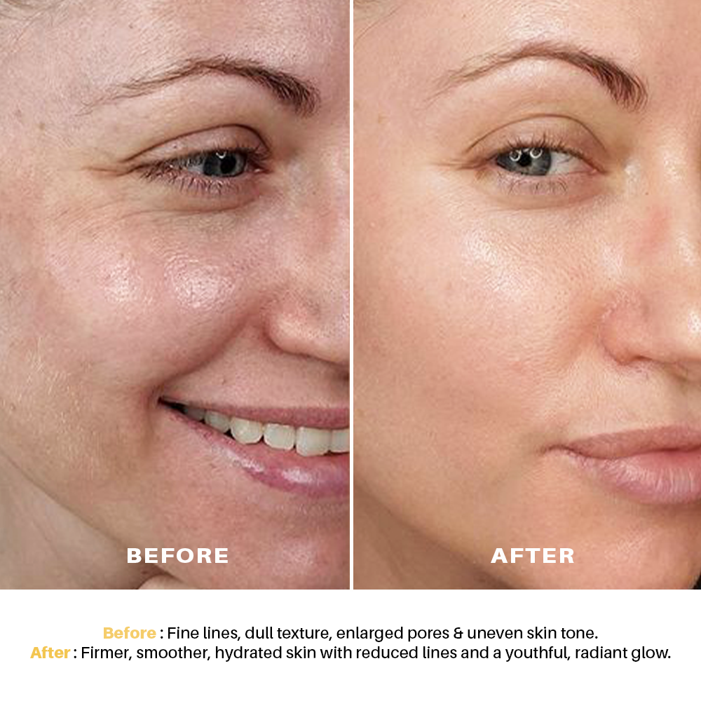 Seasoul Peel-Off Mask Anti-Ageing With Bakuchiol & Niacinamide (20g)