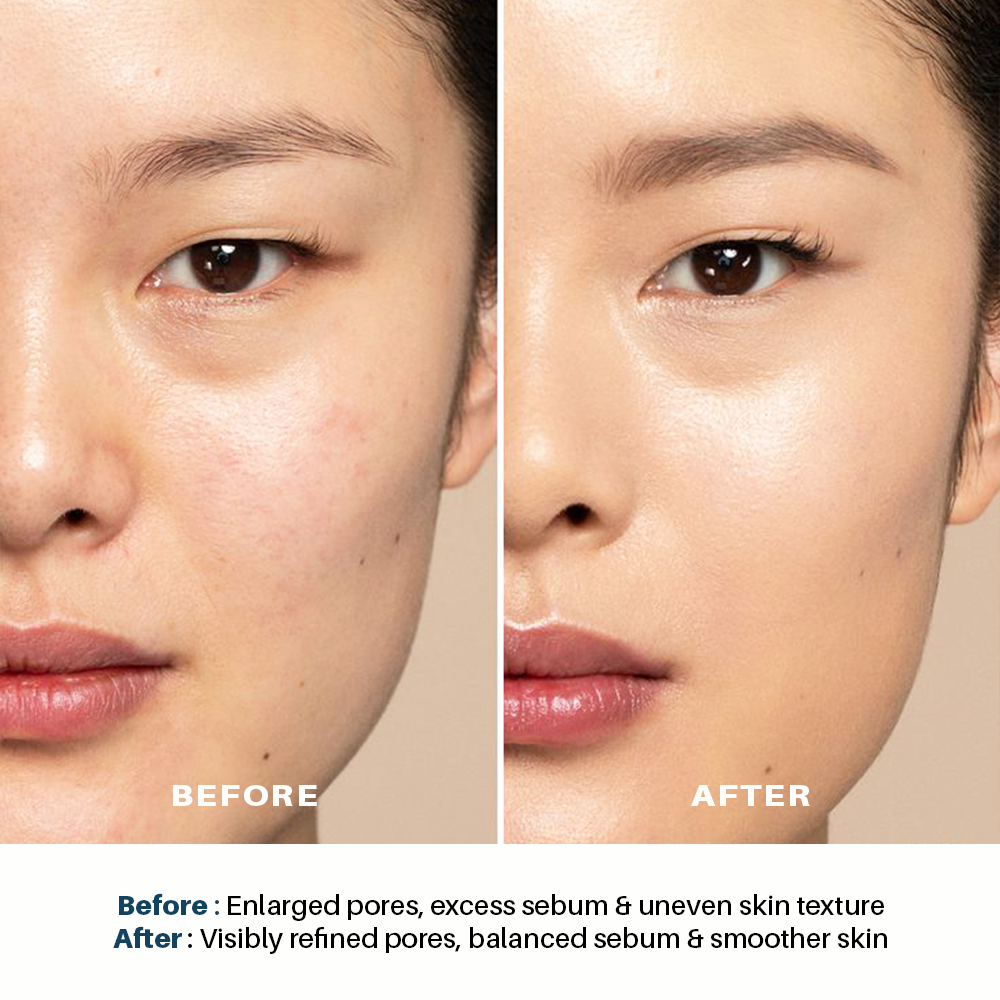 Pore Minimizing Serum