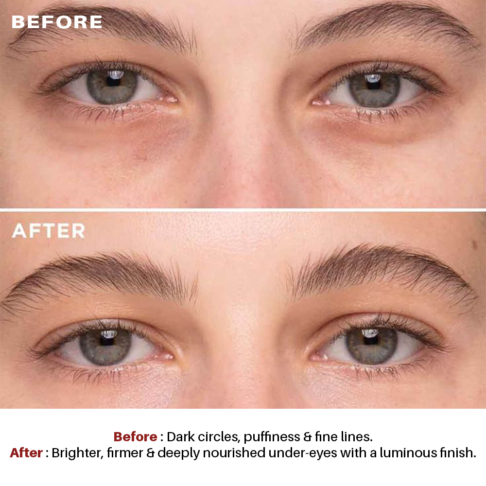 Intensive Lightening Eye Serum