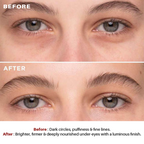 Intensive Lightening Eye Serum