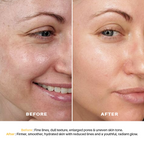 Seasoul Peel-Off Mask Anti-Ageing With Bakuchiol & Niacinamide (20g)