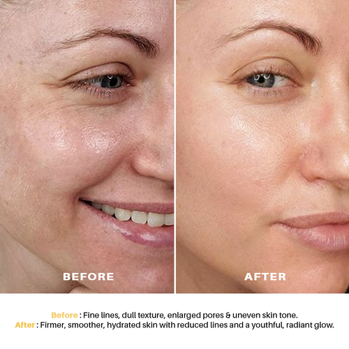 Anti-Ageing Peel-Off Mask