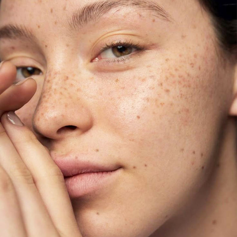 Pigmentation